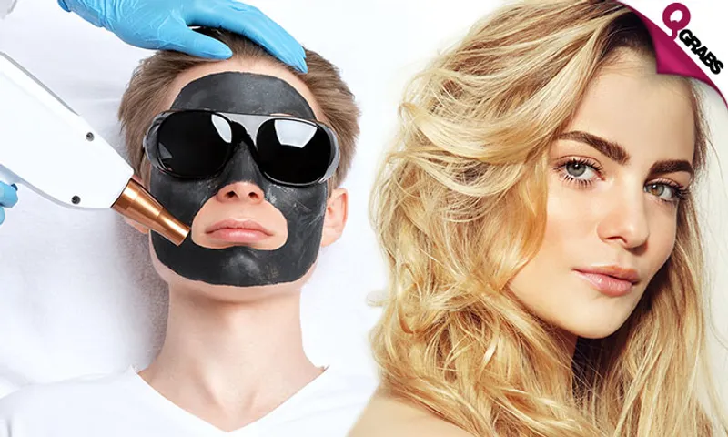 Q-Switch Laser Treatment for Carbon Peel, Hair Bleaching & More!